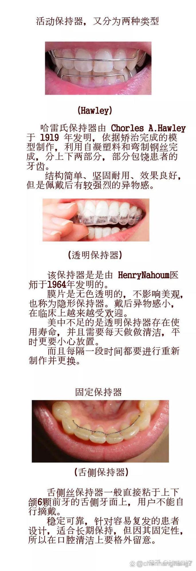 正畸保持器类型_保持器佩戴时间_不带保持器多久会反弹